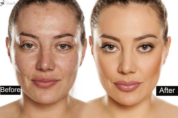 Anti Aging Skin Care | ML Delicate Beauty