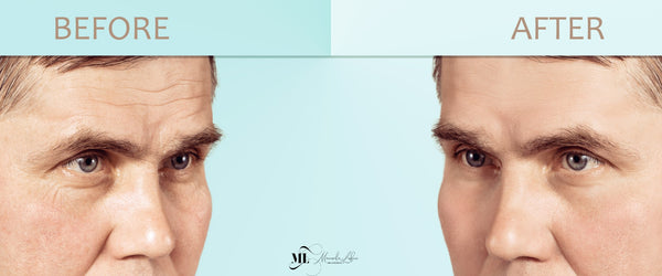 Anti aging cream for men | ML Delicate Beauty