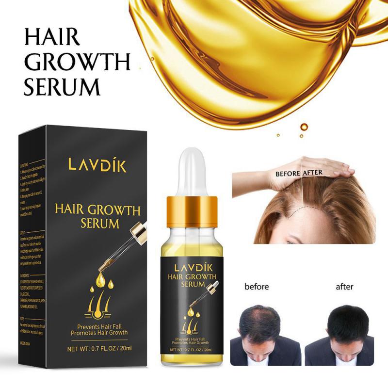 Intimify Onion Hair Oil to Promote Hair Growth 120 mL Buy Intimify Onion  Hair Oil to Promote Hair Growth 120 mL at Best Prices in India  Snapdeal