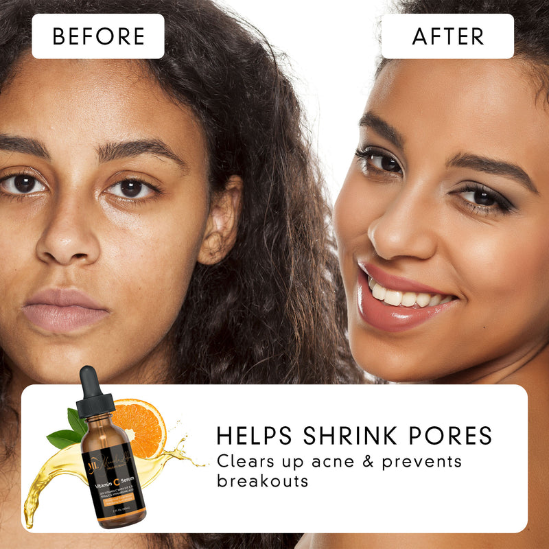 Before and after facial Vitamin C serum skincare products
